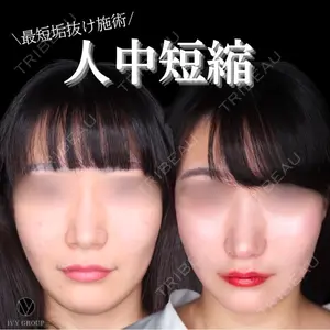 90 days after image
