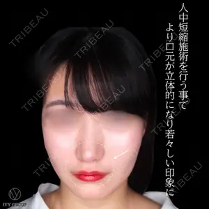 90 days after image
