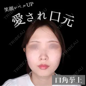 30 days after image