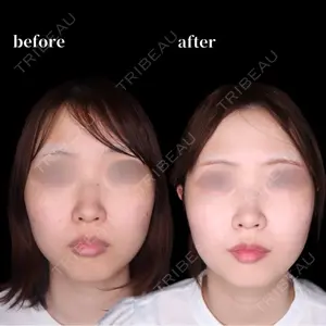 30 days after image