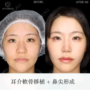 90 days after image
