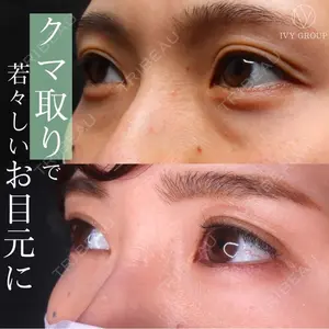 30 days after image