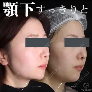 30 days after image
