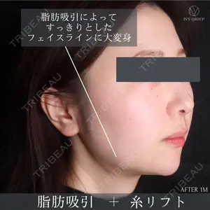 30 days after image