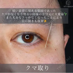 30 days after image