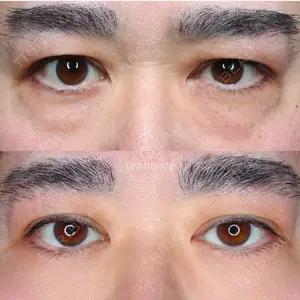 30 days after image