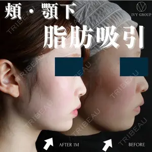 30 days after image
