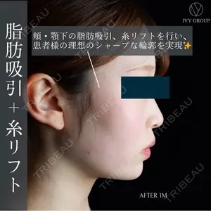 30 days after image