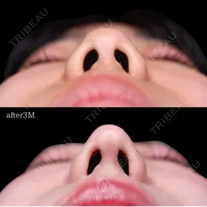 90 days after image