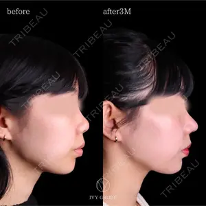 90 days after image