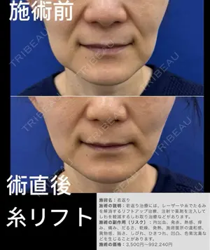 0 days after image
