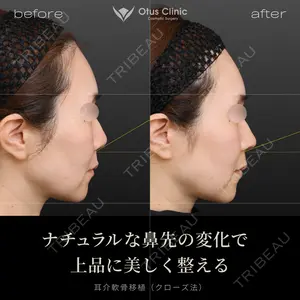 7 days after image