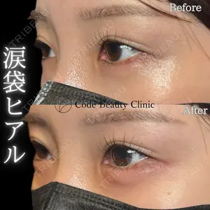 before image