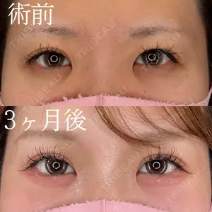 before image