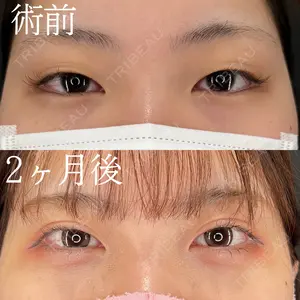 60 days after image