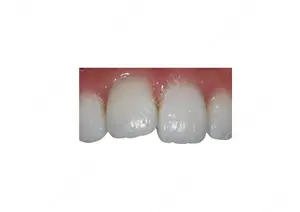 before image