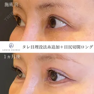 30 days after image