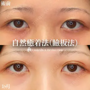 30 days after image