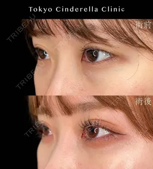 before image