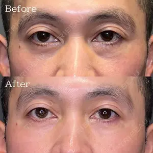 30 days after image