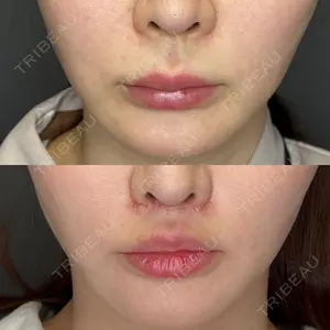 30 days after image