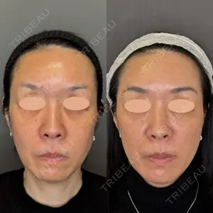 30 days after image