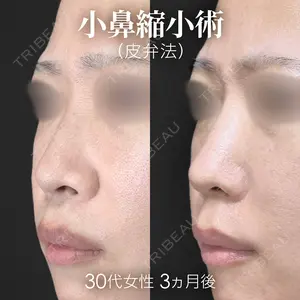 90 days after image