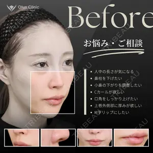 before image