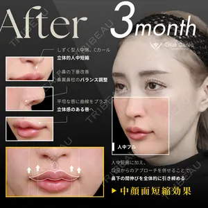 90 days after image