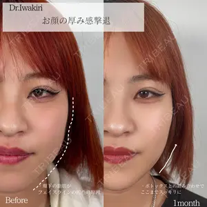 30 days after image