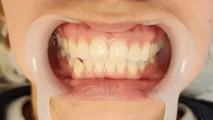 before image