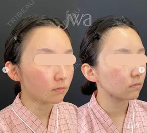 before image