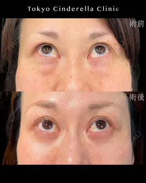 before image