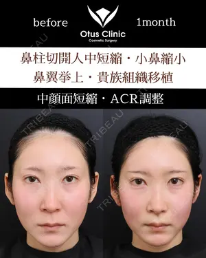 30 days after image