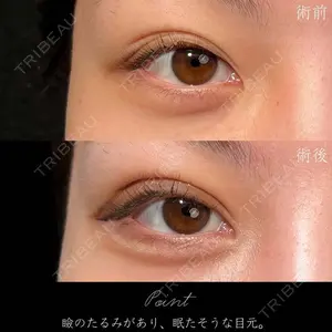 before image