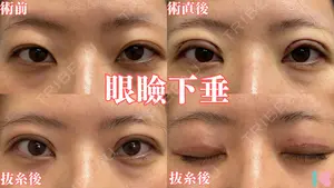 14 days after image