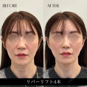 null days after image