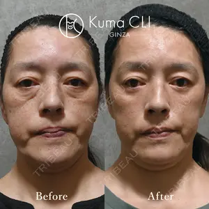 180 days after image