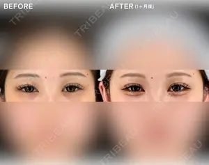 before image