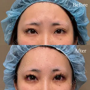 30 days after image