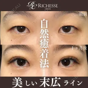 before image