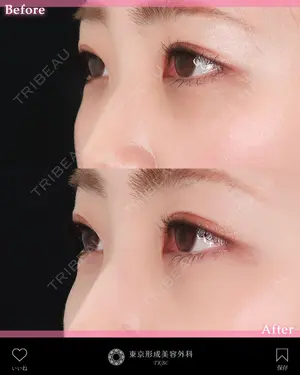 before image