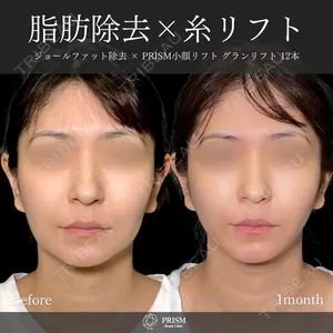 30 days after image