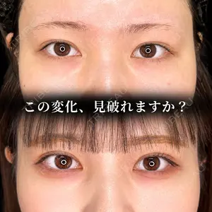 7 days after image
