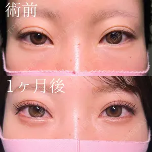 before image