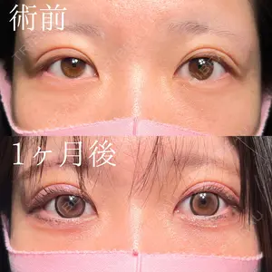 30 days after image
