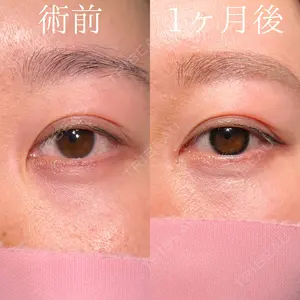 before image