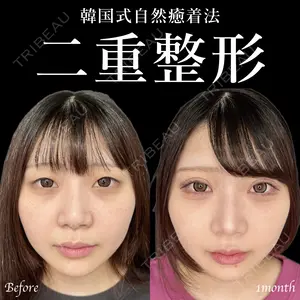 30 days after image