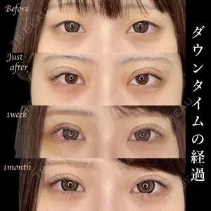 30 days after image