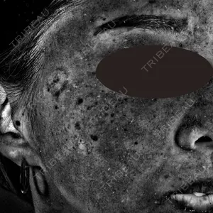 180 days after image